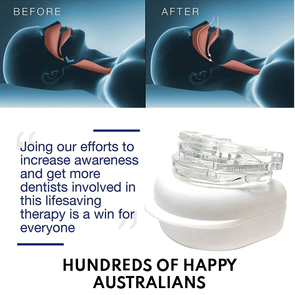 Dispositif Anti-Ronflement SilentForm – Réglable, Confort Optimisé, Solution Efficace pour le Sommeil