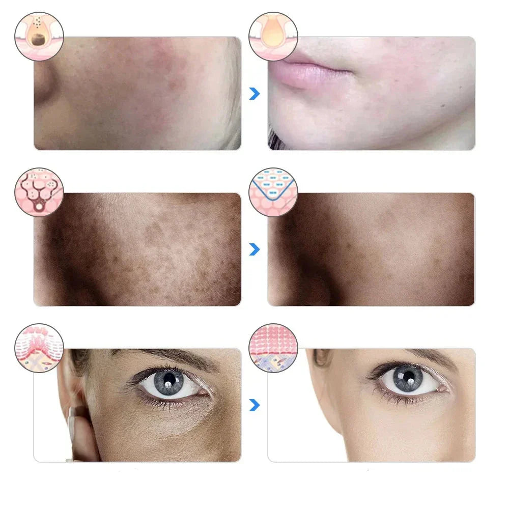 Masque Thérapeutique LED AgeGlow | Lifting Visage & Éclat de la Peau à Domicile
